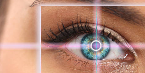 Mengenal LASIK Mata sebagai Solusi Koreksi Penglihatan Modern